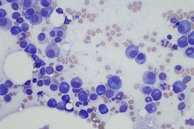 microscopic cells on a slide