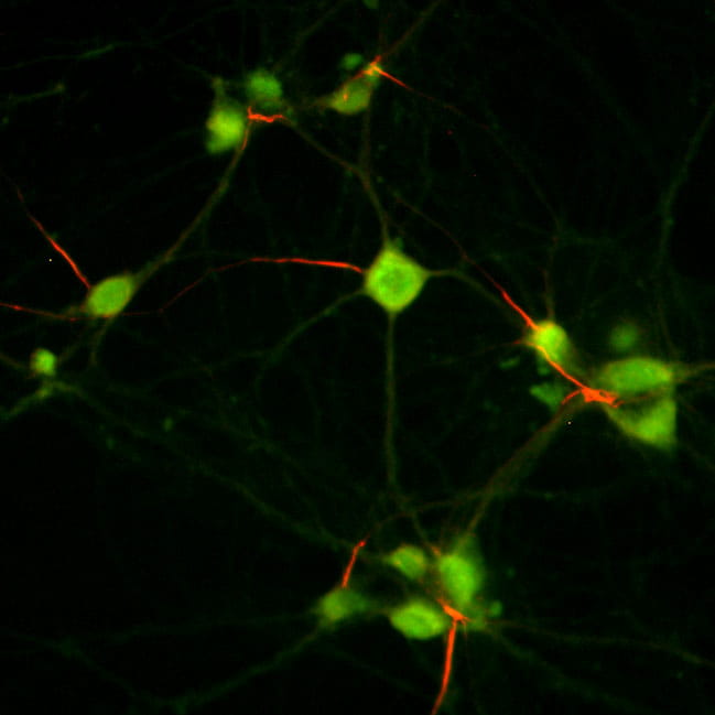 This image shows fluorescent labeling of Kv7 channel expression in neurons.