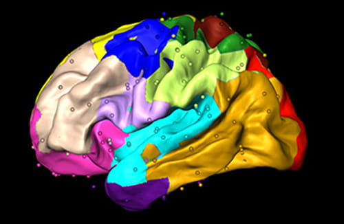 A colorful image showing sections of the brain