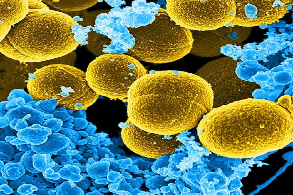 Staphylococcus aureus 4. Стрептококк ауреус. Staphylococcus aureus царство. Золотистый стафилококк септицемия.
