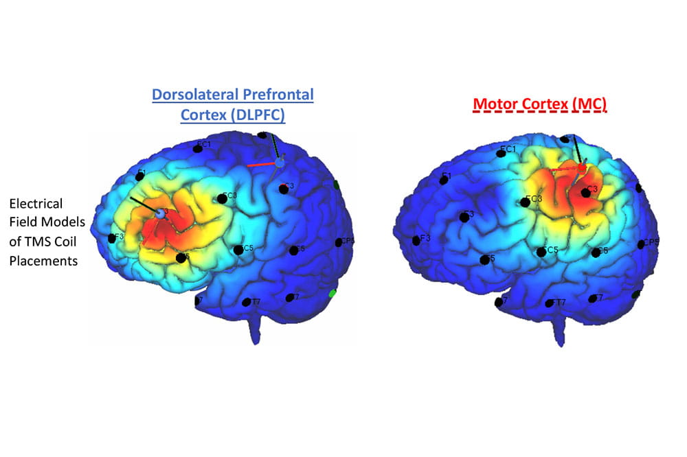 Illustration of two brains showing the motor cortex, located near the middle of the skull, and the DLPFC, closer to the front.