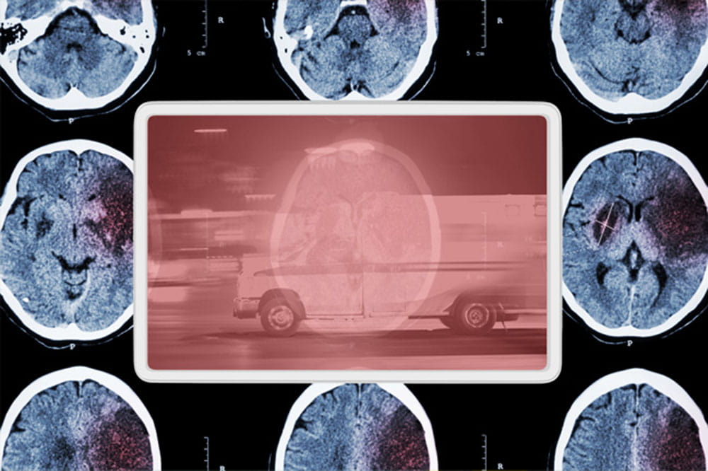 Illustration showing an ambulance surrounded by images of strokes.