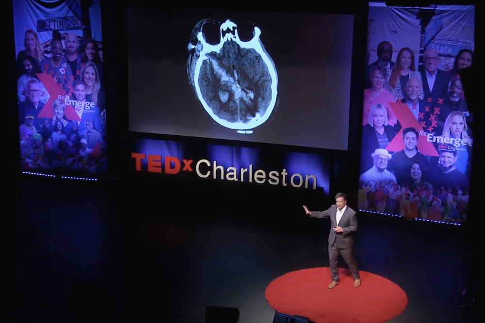 Surgeon Alex Spiotta stands on stage giving a TEDx talk in front of a large projection screen with an image of an MRI of a human skull