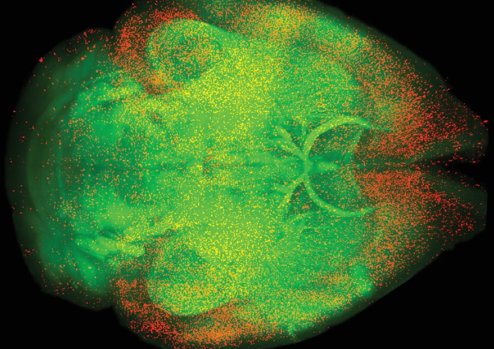 Brain map shows active neurons following administration of oxycodone.