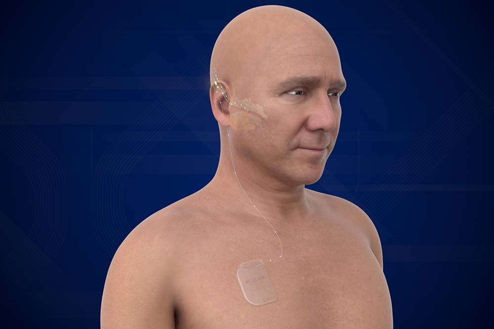 A man's upper body. You can see faint outlines of a hearing aid that's under his skin.