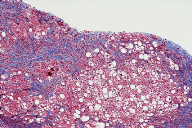 Decorative image of liver cells