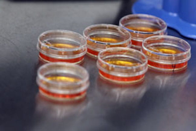 islet cells inset