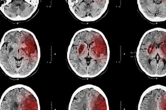 Decorative image of brain scans